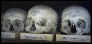 Skulls